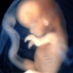 Hvordan trækker en baby vejret i maven og andre spørgsmål den gravide stiller